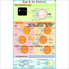 The Eyes: It’s Defects & Remedies-vcp